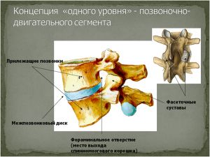 Рис.1. Фораминальное отверстие в поясничном отделе позвоночника. Образовано спереди нижним краем тела  позвонка и диском, сзади фасеточным суставом, сверху и снизу корнями дуг.